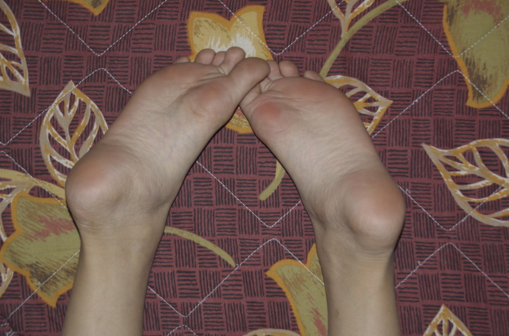 足の指の骨折やひびの症状・治療法まとめ