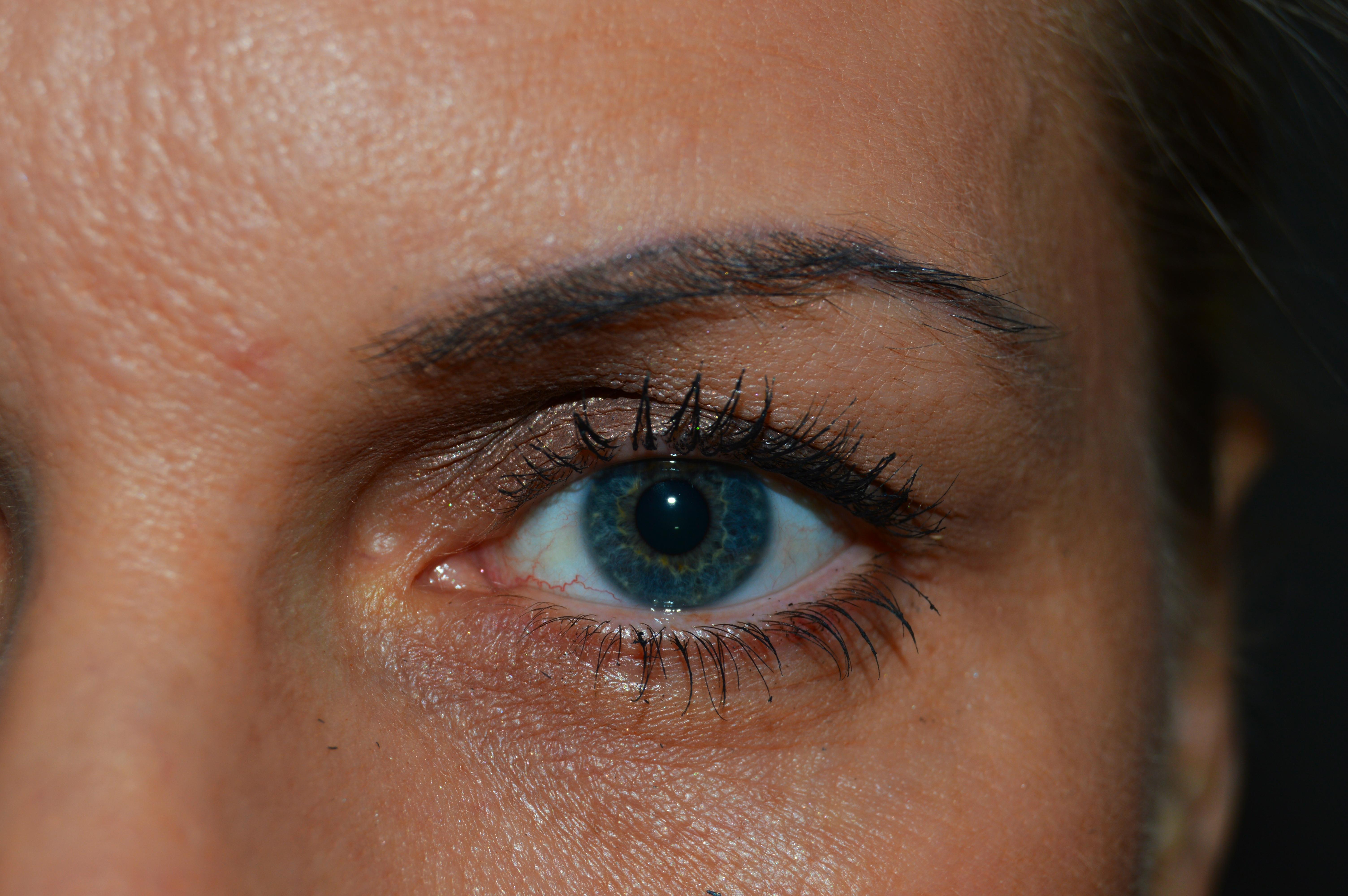 目の痙攣、上まぶたの場合は何が原因？